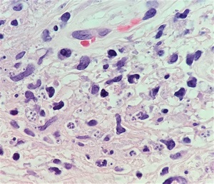 Case481_A Parasitic Image
