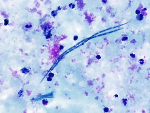 AUGUST - 2018 - CASE #474 parasitic image