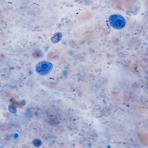 Case483_A parasitic image