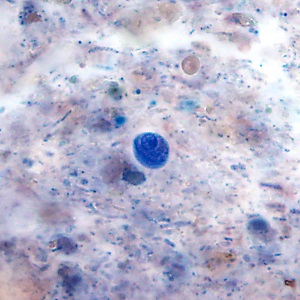 Case483_C parasitic image
