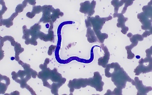 JANUARY - 2019 - CASE #484 parasitic image