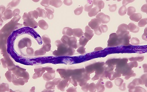 Case484_D parasitic image