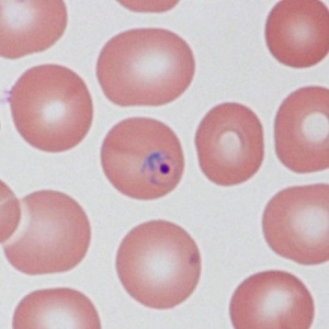 FEBRUARY - 2019 - CASE #485 Parasitic image