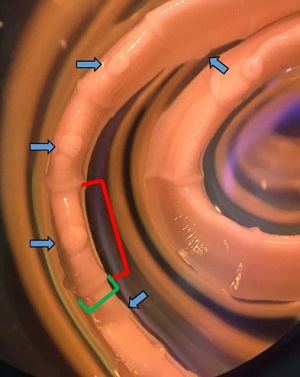 Case489_B Answer Figure B