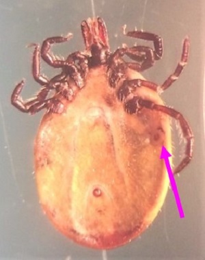 Case490_B Answer Figure B