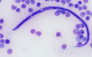 May - 2019 - CASE #491 parasitic image