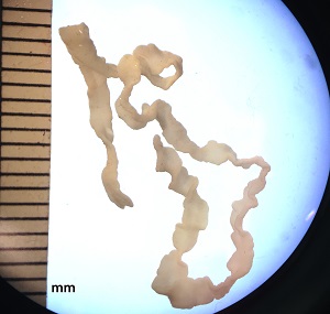 JUNE - 2019 - CASE #493 parasitic image