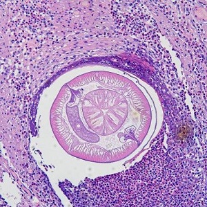 AUGUST - 2019 - CASE #498 parasitic image