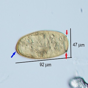 Case_504_C_Answer Figure
