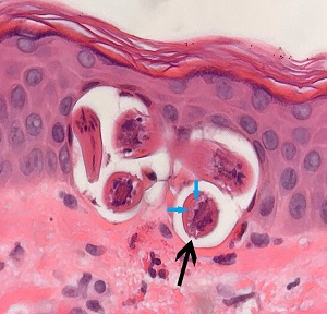 523_B_answer Case_520_answer