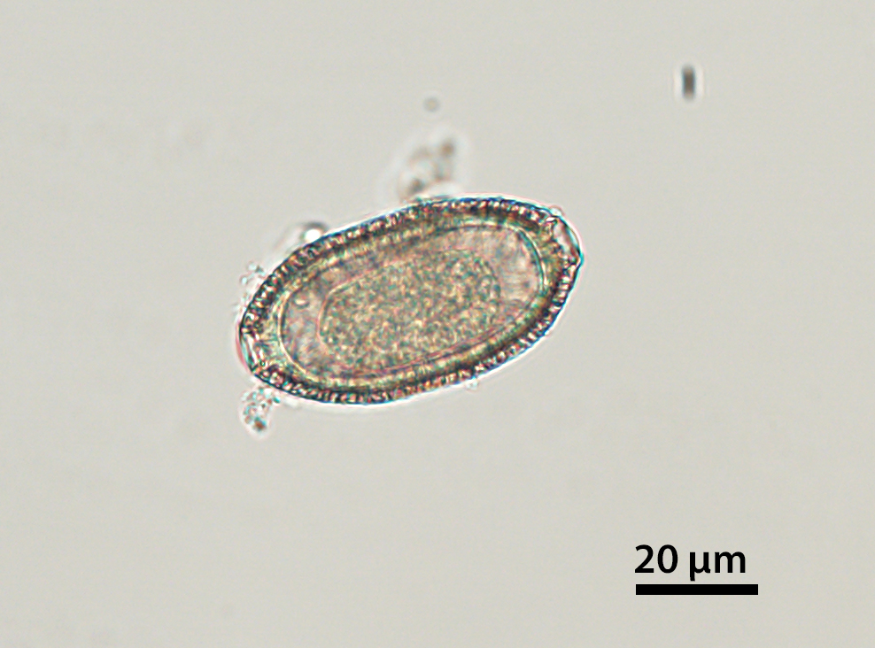 OCTOBER - 2020 - CASE #526 parasitic image