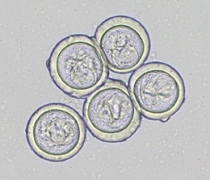 APRIL - 2020 - CASE #513 parasitic image