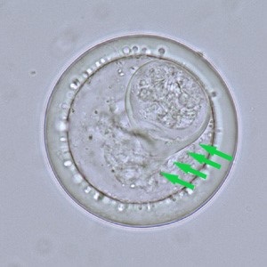 Case_513_B_Answer Case_513_B_answer