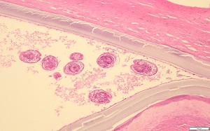 MAY - 2020 - CASE #516 parasitic image