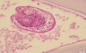 Case_516_C Case_516_C