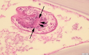 Case_513_B_Answer Case_516_C_answer