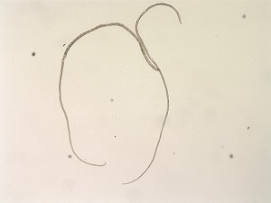 JUNE - 2020 - CASE #518 parasitic image