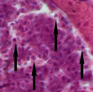 Case_519_B_Answer Case_519_B_answer