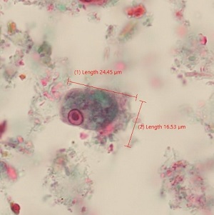 JULY - 2020 - CASE #520 parasitic image