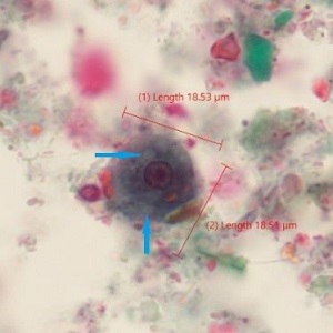 Case_520_B_Answer Case_520_B_answer