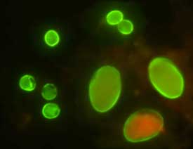 Duodenalis cyst. [Cryptosporidium and Giardia as water contaminant pathogens in Hungary].