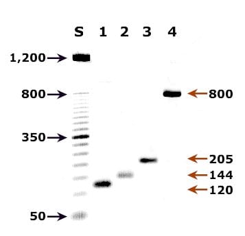 Agarose gel (2%) analysis of a PCR diagnostic test for species-specific detection of Plasmodium DNA.