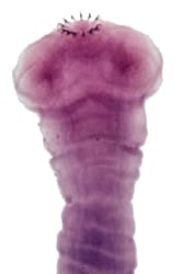 Taenia solium scolex