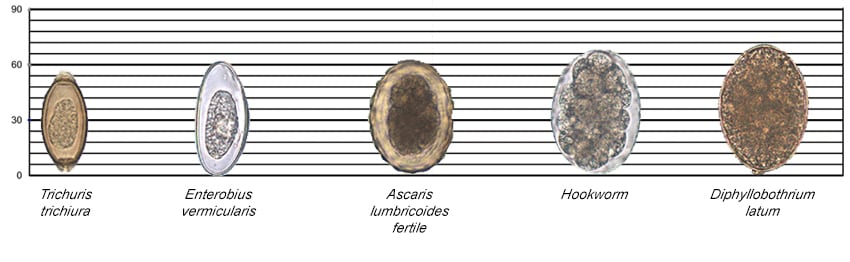 Images of Trichuris trichiura, Enterobius vermicularis, Ascaris lumbricoides fertile egg, Hookworm ,and Diphyllobothriumlatum along a scale for reference.