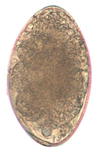 Echinostoma egg