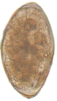 Fasciola hepatica egg