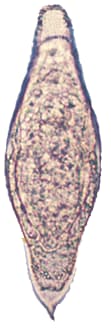 Schistosoma intercalatum egg