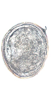 Schistosoma japonicum egg