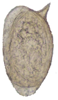 Schistosoma mansoni egg