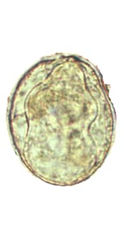 Schistosoma mekongi egg