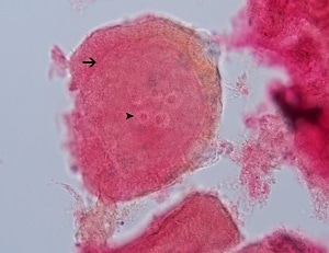 Figure C: Carmine-stained egg capsule of <em>I. madagascariensis</em> freed from proglottid. Note the visible cluster of eggs (dart; 5 in this specimen) and the division of two “zones” (arrow) making up the inner and outer portions of the egg capsule.  
