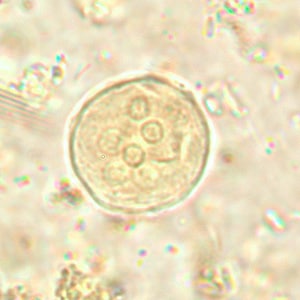 Figure A: Cyst of <em>E. coli</em> in a unstained concentrated wet mount. Six nuclei are visible in this focal plane.