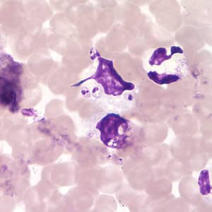 Figure C: <em>Leishmania (Viannia)</em> panamensis amastigotes in a Giemsa-stained tissue scraping.