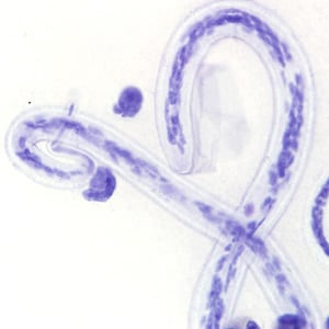 Figure A: Microfilaria of <em>L. loa</em> a thick blood smear from a patient from Cameroon, stained with Giemsa. Note the nuclei extending to the tip of the tail to the left of the image.