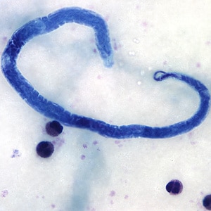 Figure B: Microfilaria of <em>L. loa</em> in a thick blood smear, stained with Giemsa.