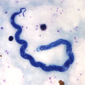 Figure C: Microfilaria of <em>L. loa</em> in a thick blood smear, stained with Giemsa.