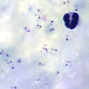 Figure B: Rings of <em>P. falciparum</em> in a thick blood smear.