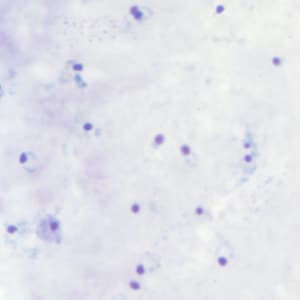 Figure C: Rings of <em>P. falciparum</em> in a thick blood smear.