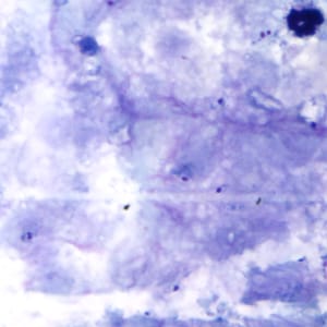 Figure F: Rings of <em>P. falciparum</em> in a thick blood smear.