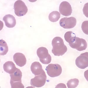 Figure L: Rings of <em>P. falciparum</em> in a thin blood smear. Image courtesy of the Arizona State Public Health Laboratory.