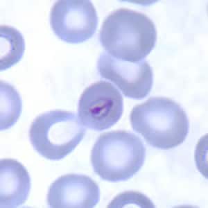 Plasmodium malária tojások