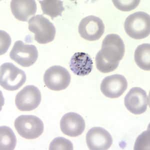 Figure D: Gametocyte of <em>P. malariae</em> in a thin blood smear.