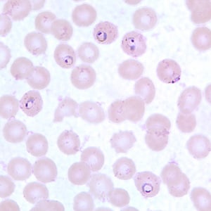 a malária plazmodium gametogóniája)