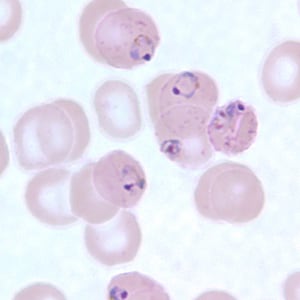 Figure C: Ring-form trophozoites of <em>P. falciparum</em> in a thin blood smear, exhibiting Maurer's clefts.