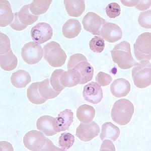 Mi a neve a malária plazmodium aszexuális reprodukciójának