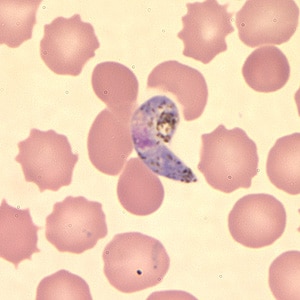 Figure D: Ookinete of <em>P. vivax</em> in a thin blood smear.